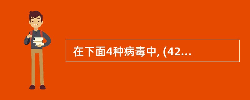  在下面4种病毒中, (42) 可以远程控制网络中的计算机。(42)