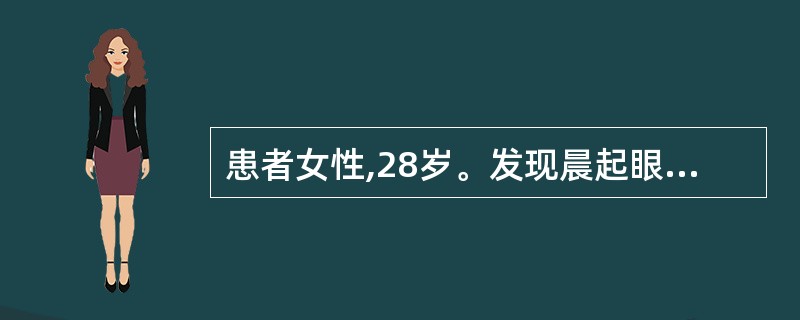 患者女性,28岁。发现晨起眼睑水肿3年,腰酸,血压165£¯90mmHg,血红蛋