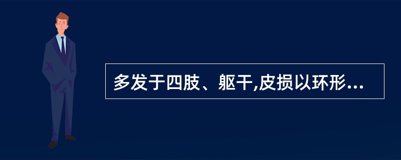 多发于四肢、躯干,皮损以环形排列的群集水疱为主。其诊断是( )