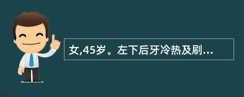 女,45岁。左下后牙冷热及刷牙时酸痛感,刺激去除后酸痛感立即消失。检查:左下颌第