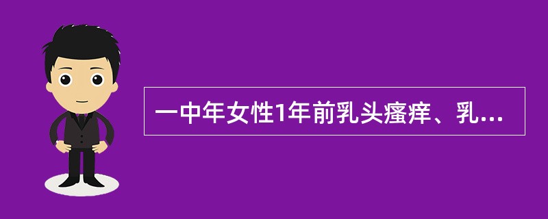 一中年女性1年前乳头瘙痒、乳晕皮肤发红、脱屑、久治不愈，乳头变平，未触及肿块及腋