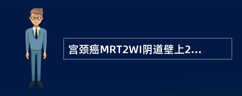 宫颈癌MRT2WI阴道壁上2／3出现异常高信号。但未见宫旁或盆壁浸润征象，应为（