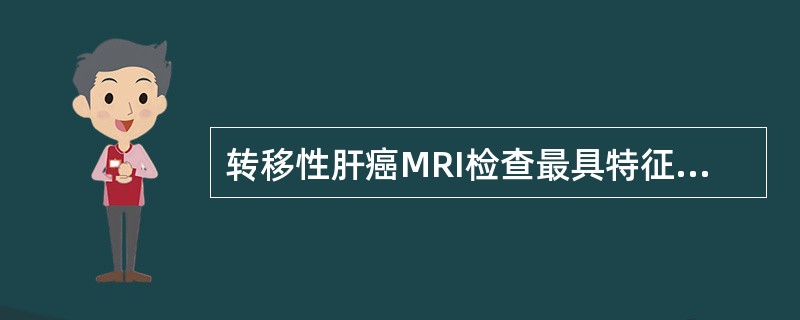 转移性肝癌MRI检查最具特征性的征象是（）