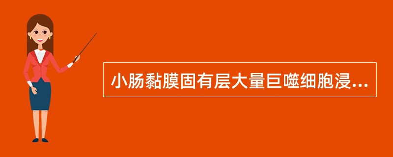 小肠黏膜固有层大量巨噬细胞浸润，巨噬细胞的胞质内充满了大量可被PAS染色的糖蛋白