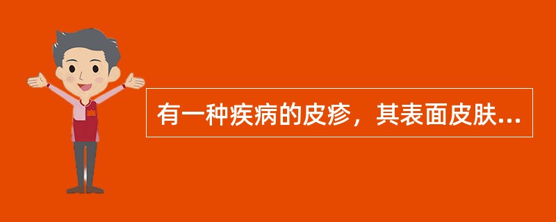 有一种疾病的皮疹，其表面皮肤发红，主要分布在小腿伸侧面的结节，不破溃，压之疼痛，