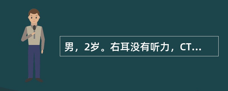 男，2岁。右耳没有听力，CT检查如图。最可能的诊断是（）