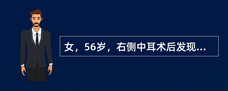 女，56岁，右侧中耳术后发现右外耳道新生物1年，PE：右外耳道内段被新生物充满，