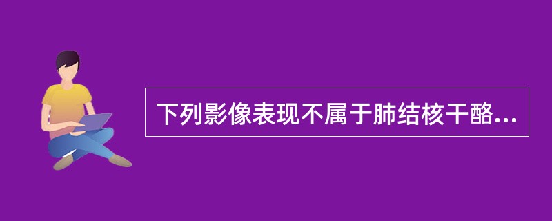 下列影像表现不属于肺结核干酪性病灶的是（）