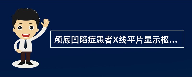 颅底凹陷症患者X线平片显示枢椎齿状突超过腭枕线（）