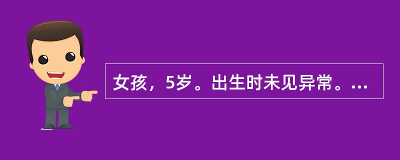 女孩，5岁。出生时未见异常。生后1个月患"肺炎"时发现青紫，以后经常发生，并在吃