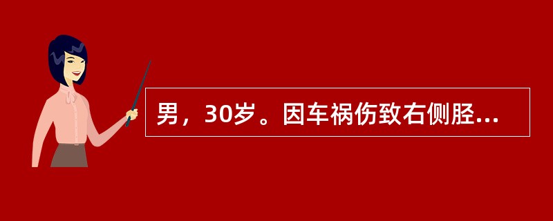 男，30岁。因车祸伤致右侧胫腓骨骨折，入院行闭合复位石膏外固定，3个月后去除外固