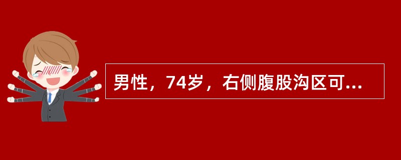 男性，74岁，右侧腹股沟区可复性肿块8年。查体：病人直立时，在腹股沟内侧端、耻骨