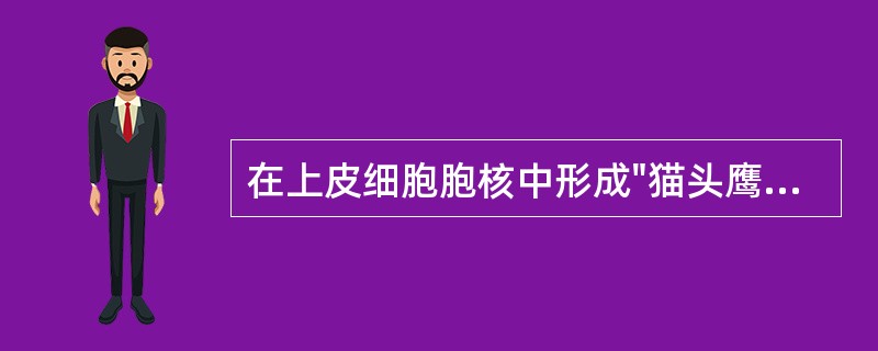 在上皮细胞胞核中形成"猫头鹰眼"样包涵体的病毒是（）。