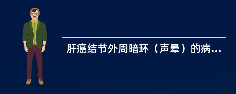 肝癌结节外周暗环（声晕）的病理学基础是：①提示肿瘤周围水肿；②提示肿瘤生长速度快