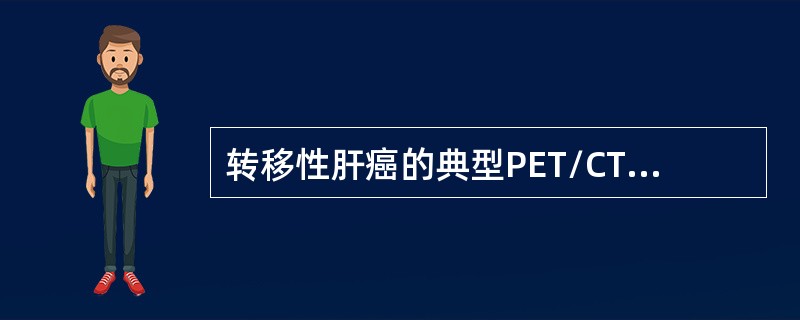 转移性肝癌的典型PET/CT征象是（）