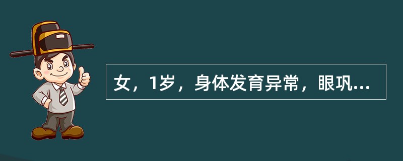 女，1岁，身体发育异常，眼巩膜呈蓝色，结合图像，最可能的诊断为()