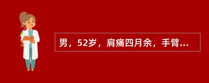 男，52岁，肩痛四月余，手臂旋转时疼痛加剧，结合影像，最可能的诊断是()