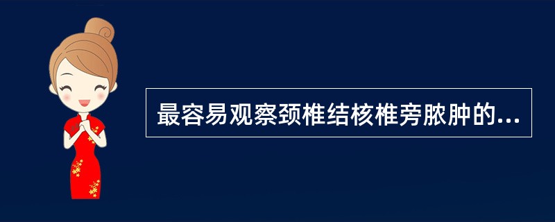 最容易观察颈椎结核椎旁脓肿的体位是()