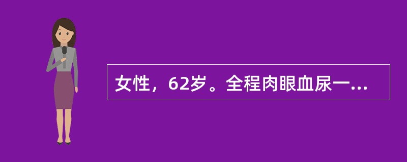 女性，62岁。全程肉眼血尿一周来诊。膀胱镜检查发现膀胱后壁直径1．6cm大小乳头