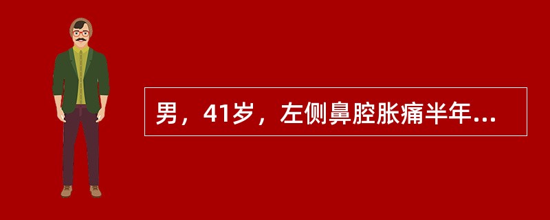 男，41岁，左侧鼻腔胀痛半年余，CT检查如图，最可能诊断为（）。