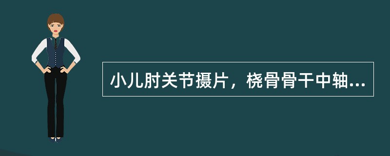 小儿肘关节摄片，桡骨骨干中轴线连线与肱骨小头骨骺中线不相连，应诊断为()