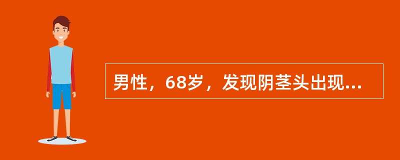 男性，68岁，发现阴茎头出现菜花样肿物半年。查体：包茎，肿物直径约3cm，菜花样