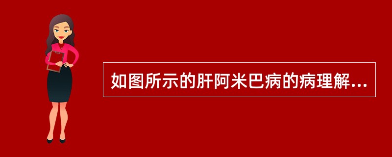 如图所示的肝阿米巴病的病理解剖，下列说法错误的是（）
