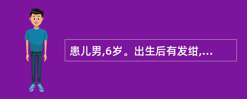 患儿男,6岁。出生后有发绀,6个月后发绀明显,平时喜欢蹲踞,哭泣时有突发性呼吸急