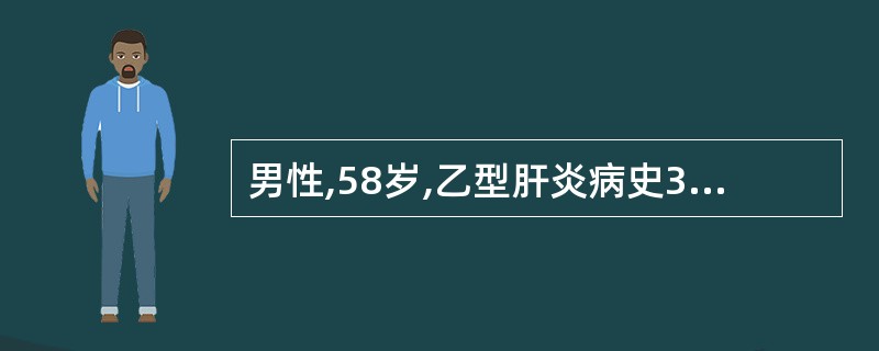 男性,58岁,乙型肝炎病史30余年。患者于2小时前进食烧饼后突然出现呕血,量约8