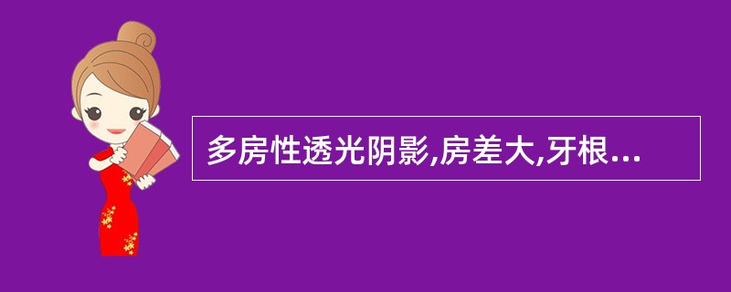 多房性透光阴影,房差大,牙根呈锯齿状吸收A、根尖囊肿B、含牙囊肿C、角化囊肿D、