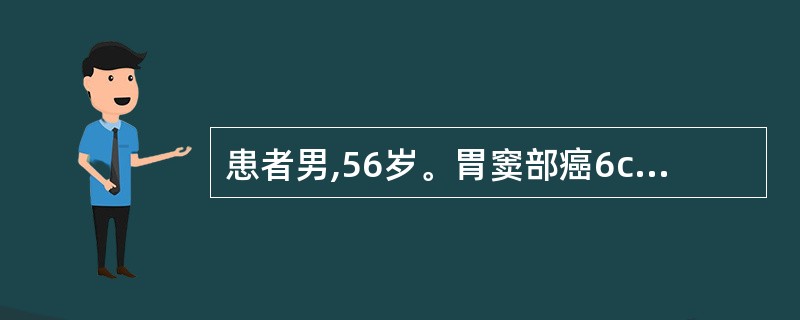 患者男,56岁。胃窦部癌6cm×4cm×4cm,已累及浆膜层。CT检查:左肝外叶