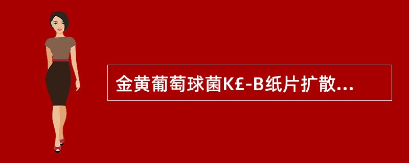 金黄葡萄球菌K£­B纸片扩散法药物敏感试验接种液的浓度为A、0.5麦氏比浊度B、