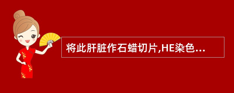 将此肝脏作石蜡切片,HE染色后,镜下可见肝细胞内有( )。[2010年真题]