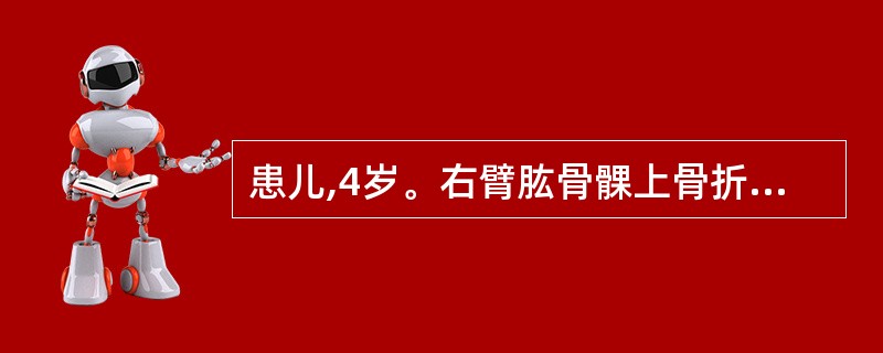 患儿,4岁。右臂肱骨髁上骨折后行石膏管型固定。3小时后出现手部苍白、发凉,桡动脉