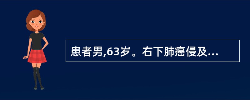 患者男,63岁。右下肺癌侵及胸壁。胸部CT检查:肺门、纵隔无肿大淋巴结,未发现远