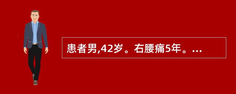 患者男,42岁。右腰痛5年。B超检查:右肾中度积水,腹部X线平片:右侧输尿管中段