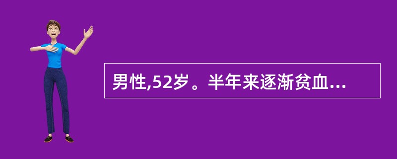 男性,52岁。半年来逐渐贫血,不发热,无出血症状,尿呈浓茶色,多为凌晨出现,巩膜