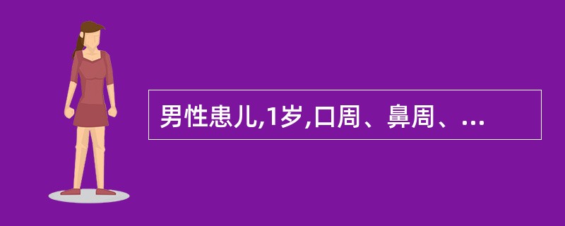 男性患儿,1岁,口周、鼻周、肛周、双手背起红色鳞屑性斑块伴腹泻3个月余就诊。患儿