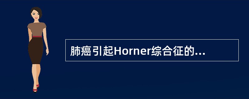 肺癌引起Horner综合征的原因是A、肺癌转移至纵隔淋巴结后压迫喉返神经B、肺癌