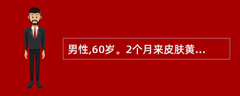 男性,60岁。2个月来皮肤黄染进行性加深伴皮肤瘙痒住院。体检:巩膜深度黄染,肝肋