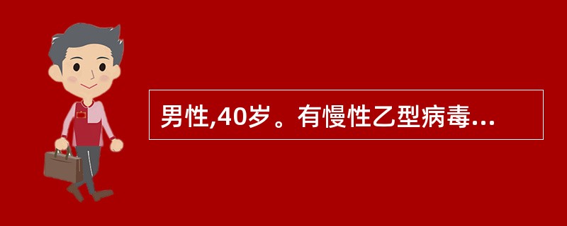 男性,40岁。有慢性乙型病毒性肝炎10年。近1年出现腹胀,腹壁静脉重度曲张,脾肿