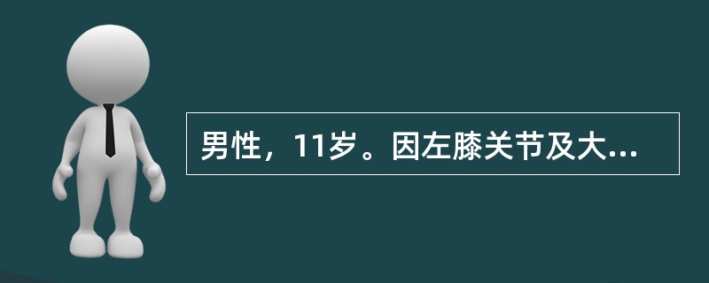 男性，11岁。因左膝关节及大腿间歇性疼痛、跛行1年就诊。以下哪一项检查的诊断与鉴