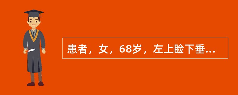 患者，女，68岁，左上睑下垂，左眼球仅能外展，瞳孔扩大，直接、间接对光反射消失，