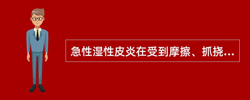 急性湿性皮炎在受到摩擦、抓挠，或（）等损伤后出现的急性炎症及渗出。