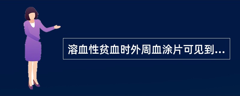 溶血性贫血时外周血涂片可见到 ( )A、明显的缗钱状形成B、有核红细胞C、网织红