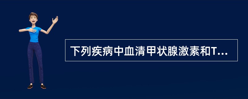 下列疾病中血清甲状腺激素和TSH浓度均升高的是A、Graves病B、甲状腺腺样瘤
