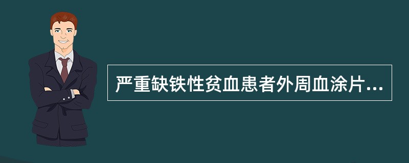 严重缺铁性贫血患者外周血涂片 ( )A、红细胞中央淡染区扩大B、可见红细胞大小不