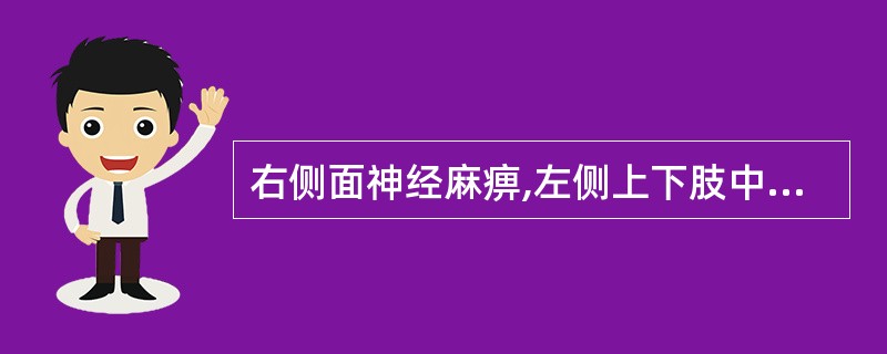 右侧面神经麻痹,左侧上下肢中枢性偏瘫( )。