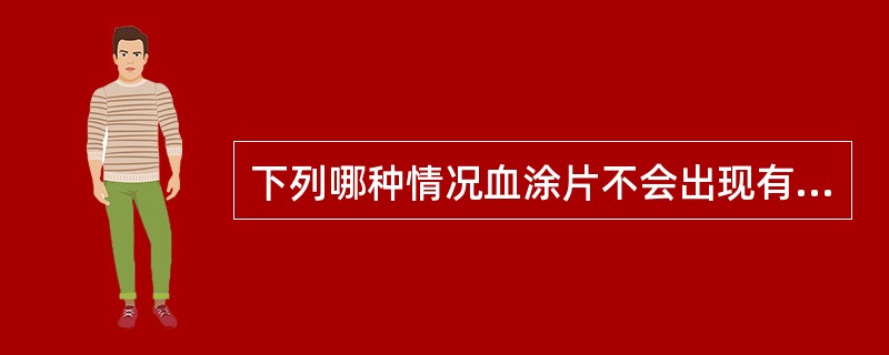 下列哪种情况血涂片不会出现有核红细胞A、溶血性贫血B、骨髓纤维化C、红白血病D、