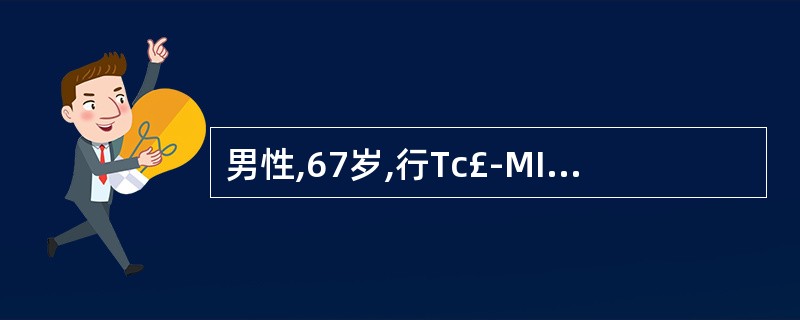 男性,67岁,行Tc£­MIBI静息£­硝酸甘油介入心肌显像如图,可能的诊断是